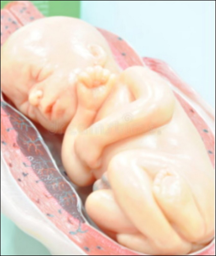 Foetus de 7 mois comme celui tué dans l'accident de Palmade